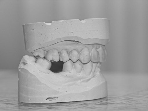 Ästhetische Zahnheilkunde